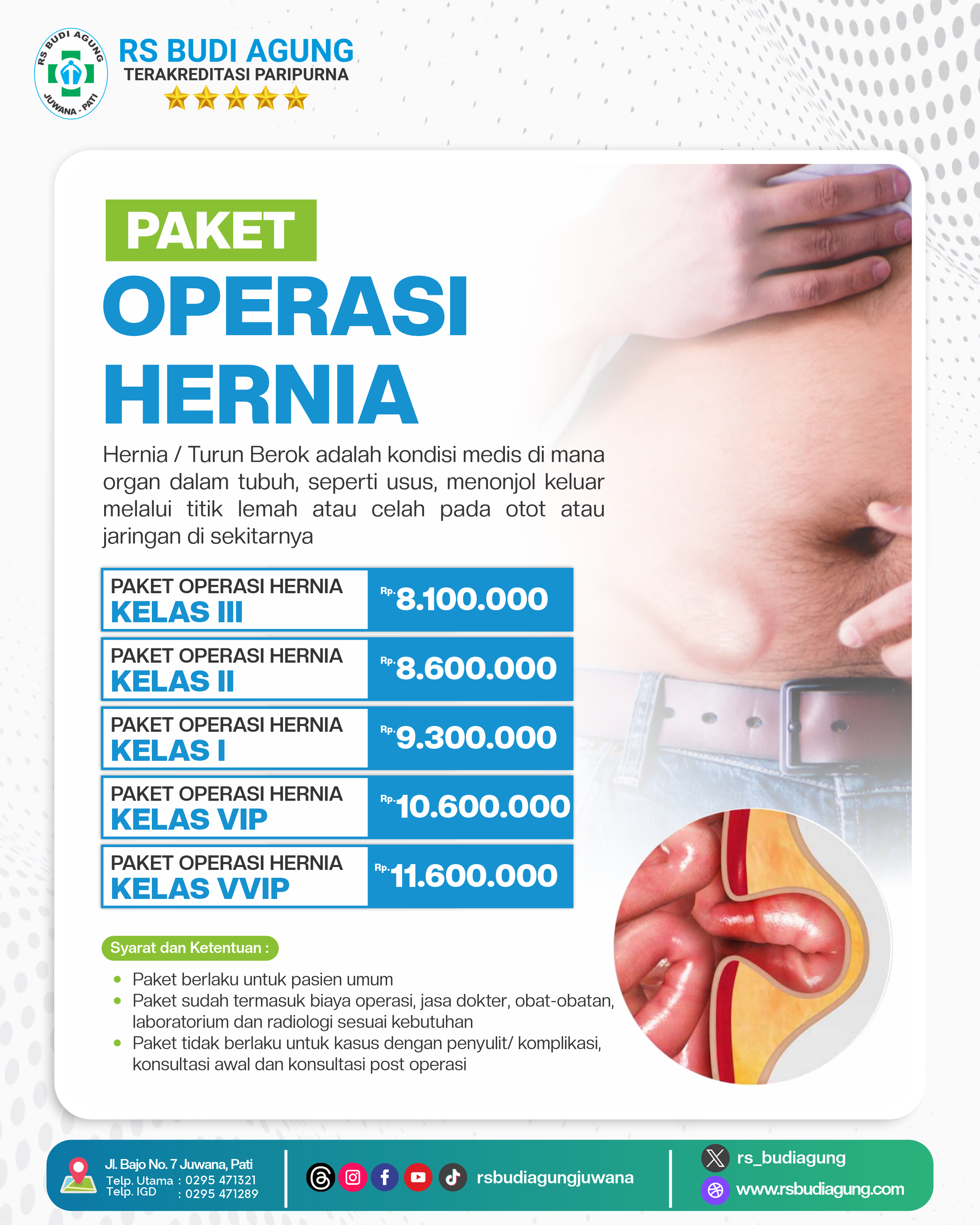 Paket Operasi Hernia